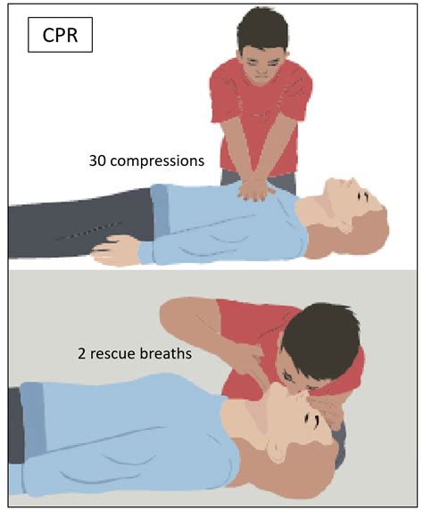 Cpr Steps For Giving
