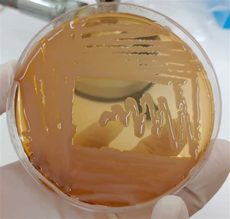 Klebsiella oxytoca, mechanism?👀 : r/microbiology