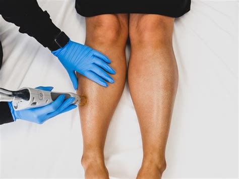 MILAN LASER HAIR REMOVAL - 22 Photos & 12 Reviews - 631 Miami Cir NE ...