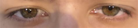 What colour are they? : r/eyes