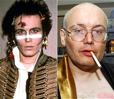80s Legend Adam Ant Opens Up About Hair Loss