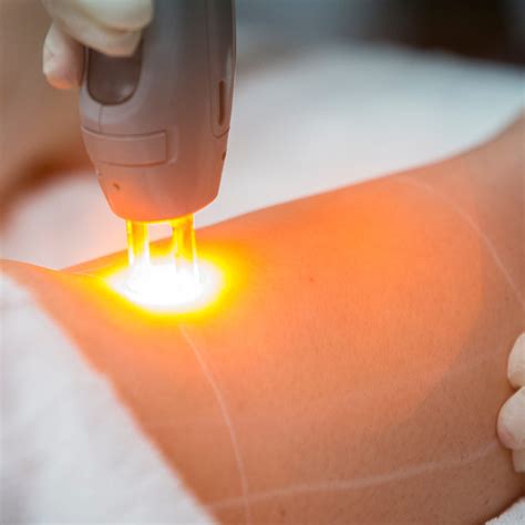 The Regulatory Landscape: Ensuring the Safe and Ethical Use of Laser