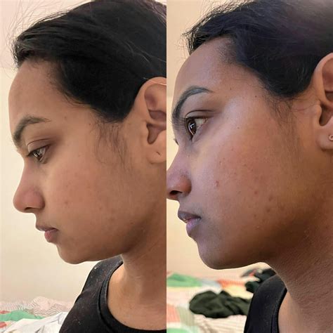 Dr Vanita Rattan Antioxidant Power Serum | Retinaldehyde, Retinol