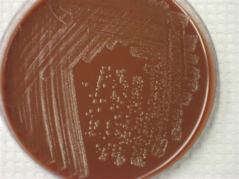 Chocolate agar - Alchetron, The Free Social Encyclopedia