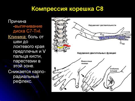Остеохондроз позвоночника - презентация онлайн