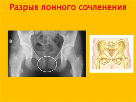 Родовой травматизм. Материнская и перинатальная смертность, пути ...
