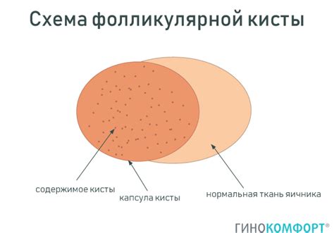 Аваріальні кісти