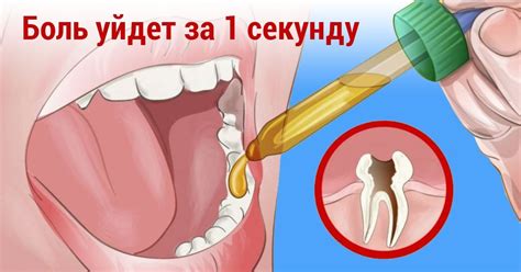 Как избавиться от зубной боли - Со Вкусом