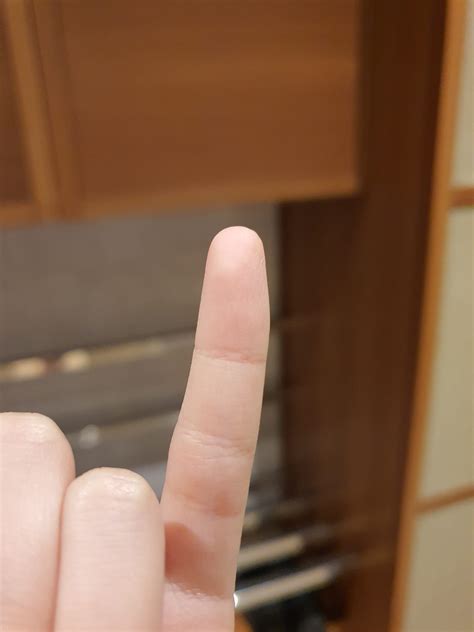 I have an extra crease on my left pinky | Scrolller