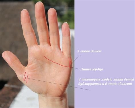 Хиромантия Линия Брака С Разъяснениями Фото — Mixyfotos.ru