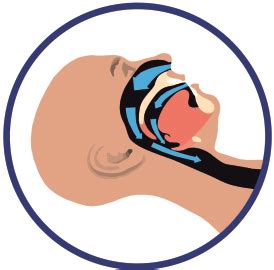 Купить капу от храпа в Москве: стоматологическая капа Dental Sleep