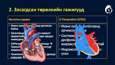 Жирэмслэлт ба зүрх судасны өвчин