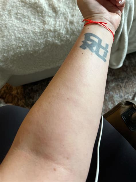 Non-itchy splotchy rash? Details in comment. : r/DermatologyQuestions