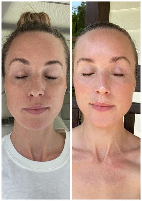 Brandybilly: Before And After Photos That Will Amaze You! Image 7