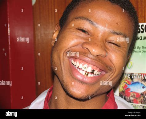 Dental gold hi-res stock photography and images - Alamy