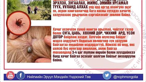 #Хачигт энцефалитын хүний өвчлөл өсөх хандлагатай байна. | By Зоонозын ...