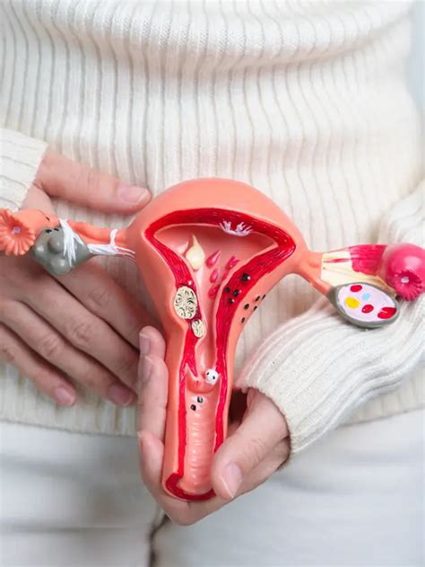 Ovarian Cancer Treatment in Chennai | VS Hospitals