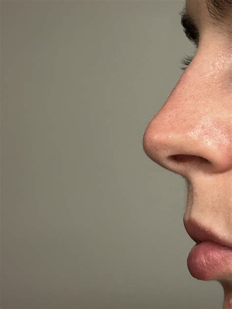 what kind of nose do I have ? Greek ? : r/Noses