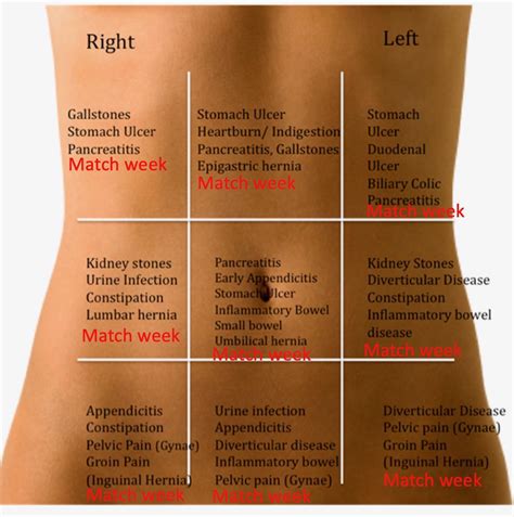 Abdominal Pain Differential Diagnosis Chart