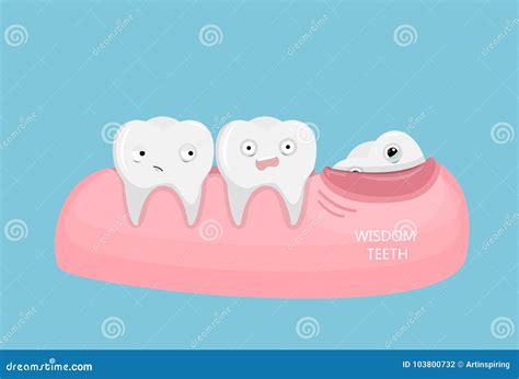 Wisdom teeth illustration. stock vector. Illustration of molar - 103800732