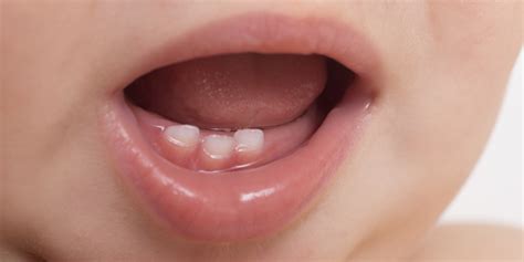 www.milkteeth.org.uk