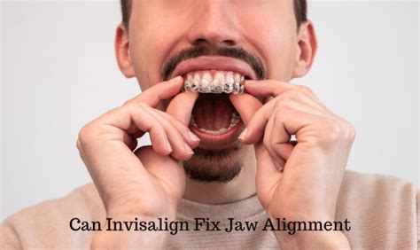 jaw out of alignment how to fix