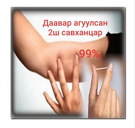 Суулгац гэж юу вэ⁉️... - Эмэгтэйчүүдийн эмнэлэг "Цогнэмэх" | Facebook