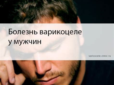Болезнь варикоцеле у мужчин / Клиника лечения варикоцеле №1
