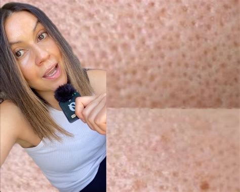 Can You Get Rid of Pores? A Skin Expert Shares the Truth... – Alpha-H ...