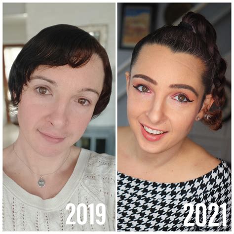 2 years difference! 39 mtf 2 years 3 months HRT - one month Post Op