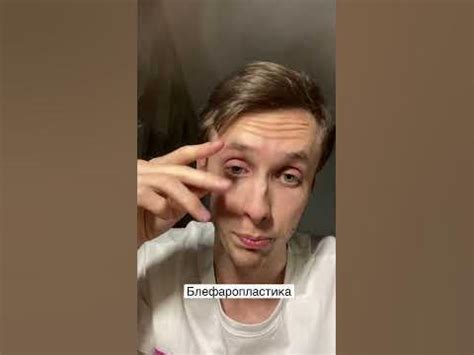 Блефорапластика в давні часи - YouTube
