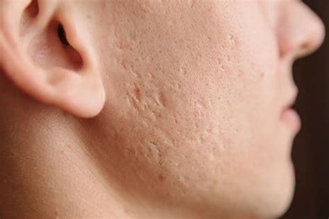 special feature managing scars aesthetics membership