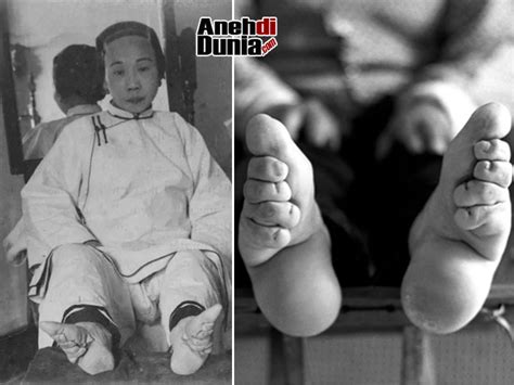 Lotus Feet Praktek Seram Ikat Telapak Kaki Wanita China Di Era Kerajaan ...