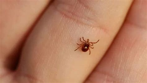 Karachi witnesses year’s first death from Congo virus