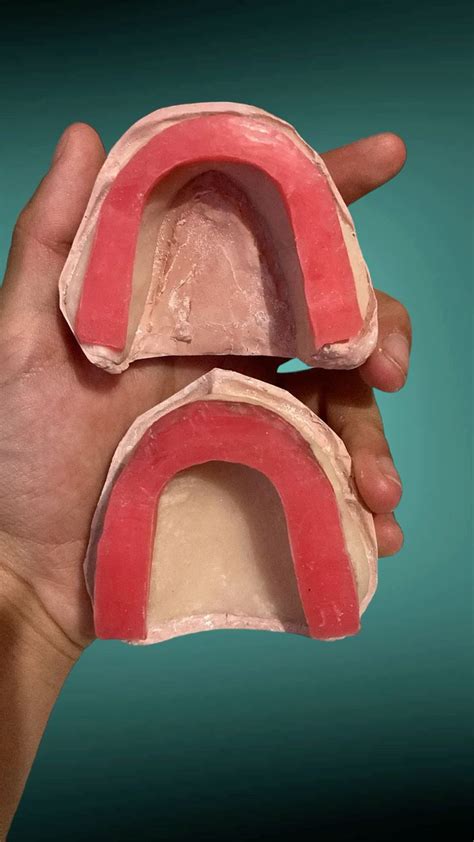 Senhora Cabelos Curtos Grisalhos - Rodillos de cera, prótesis total, placas base, práctica de prótesis ...