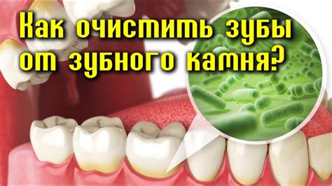 Как УДАЛИТЬ ЗУБНОЙ КАМЕНЬ и НАЛЁТ в домашних условиях? - YouTube