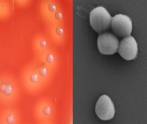 STAPHYLOCOCCUS HAEMOLYTICUS: CHARACTERISTICS, MORPHOLOGY - BIOLOGY - 2025