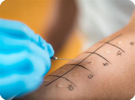 allergy skin testing nj allergist