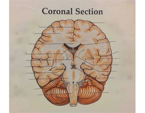 coronal cut   brain quiz