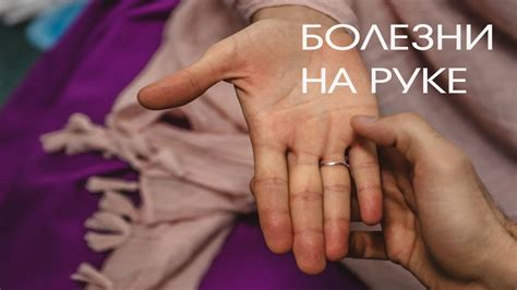 Хиромантия. Болезни на руке - YouTube
