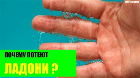 Потеют руки за рулем что делать - фото