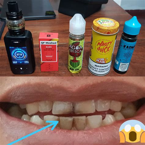 How To Drink Coffee Without Staining Teeth - Best Coffee 2022