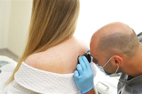 Skin Cancer Dermatologist Syracuse: Highly Effective Removal Treatment