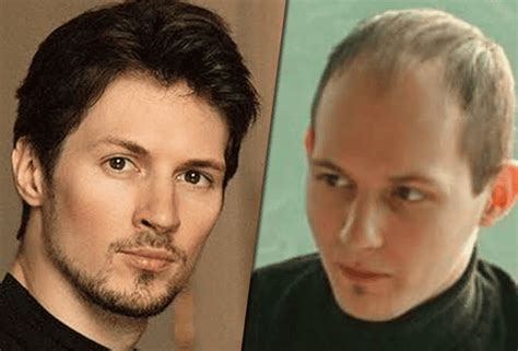 Павел Дуров пересадка волос | Фотографии до и после