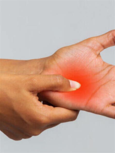 Identifying Rheumatoid Arthritis: Early Signs and Symptoms to Watch For ...