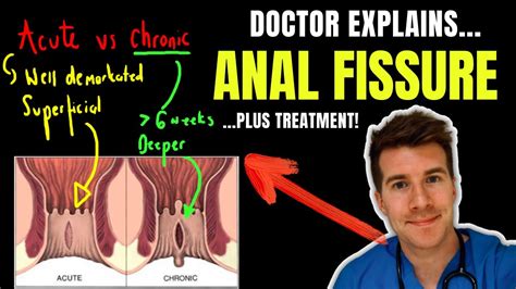 What Is A Pile Anus at Frank Jimenez blog