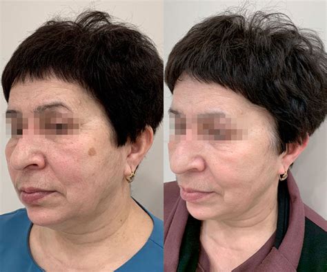 Клиника косметологии в Казани: аппаратная, эстетическая и лазерная ...