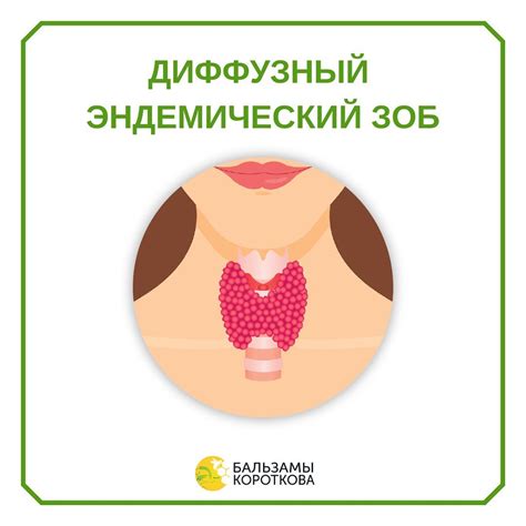 Диффузный эндемический зоб