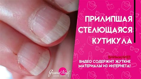 Прилипшая Стелющаяся Кутикула МК Ирины Набок GRAND NAIL - YouTube