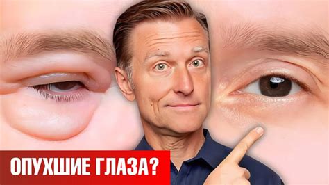 Как убрать мешки под глазами НАВСЕГДА? 🧐 - YouTube
